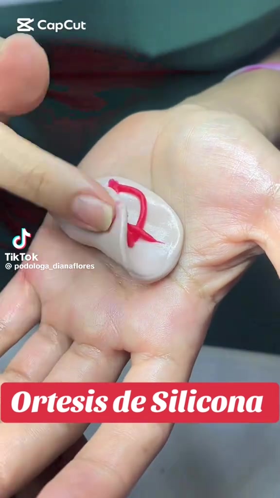 @MedicalPodoTalca importadora