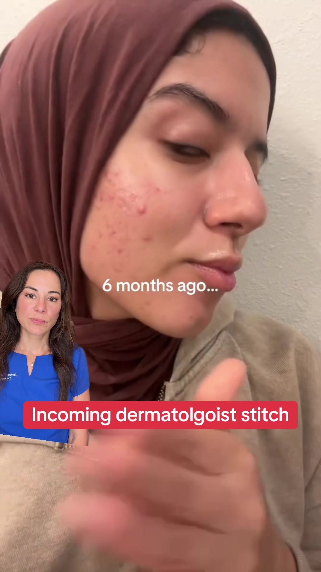 @Dermguru