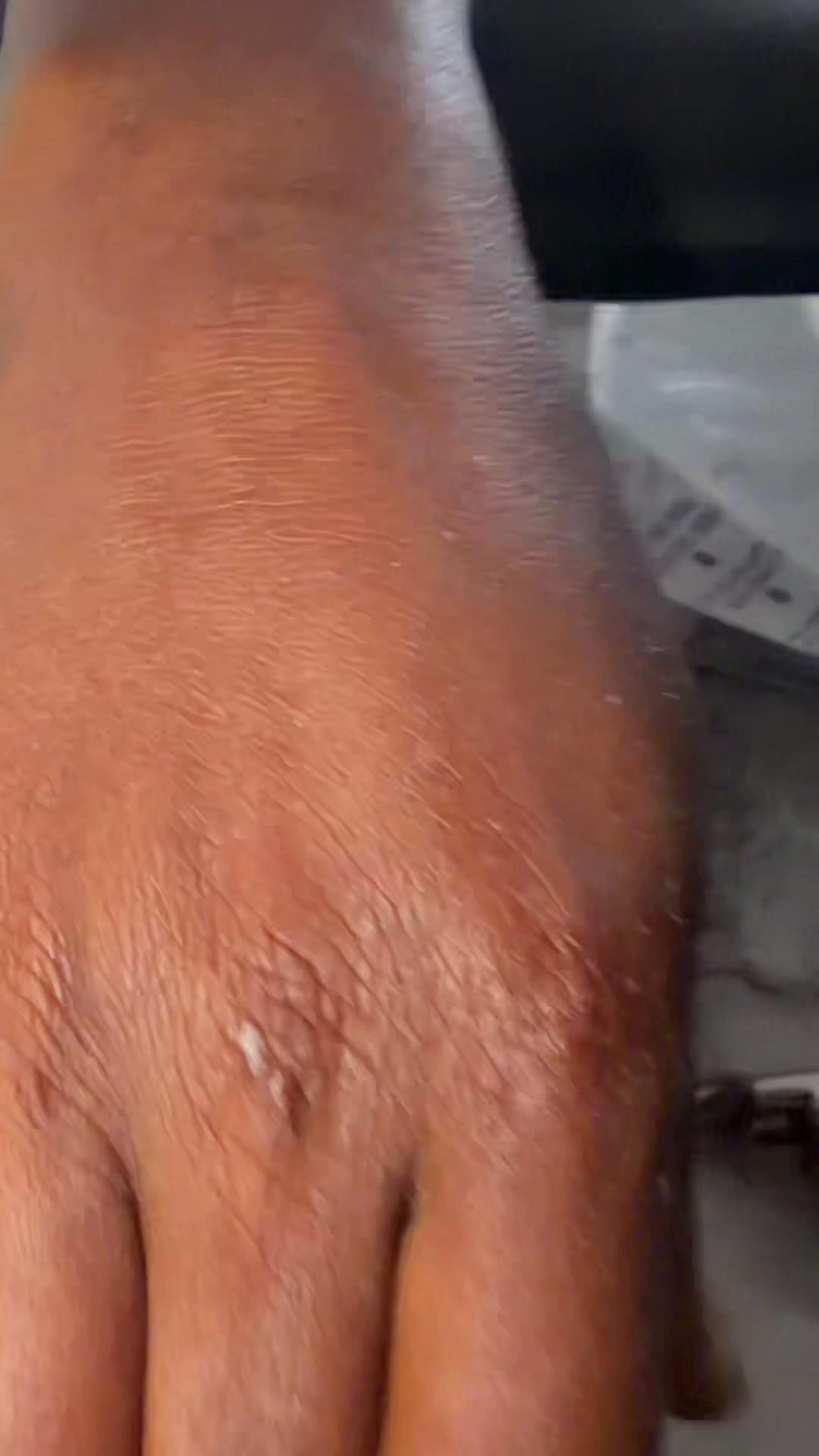 @Giftedhands