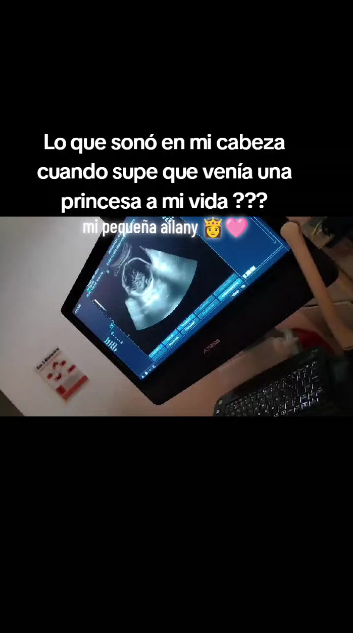 @Jon Jairo soledispa