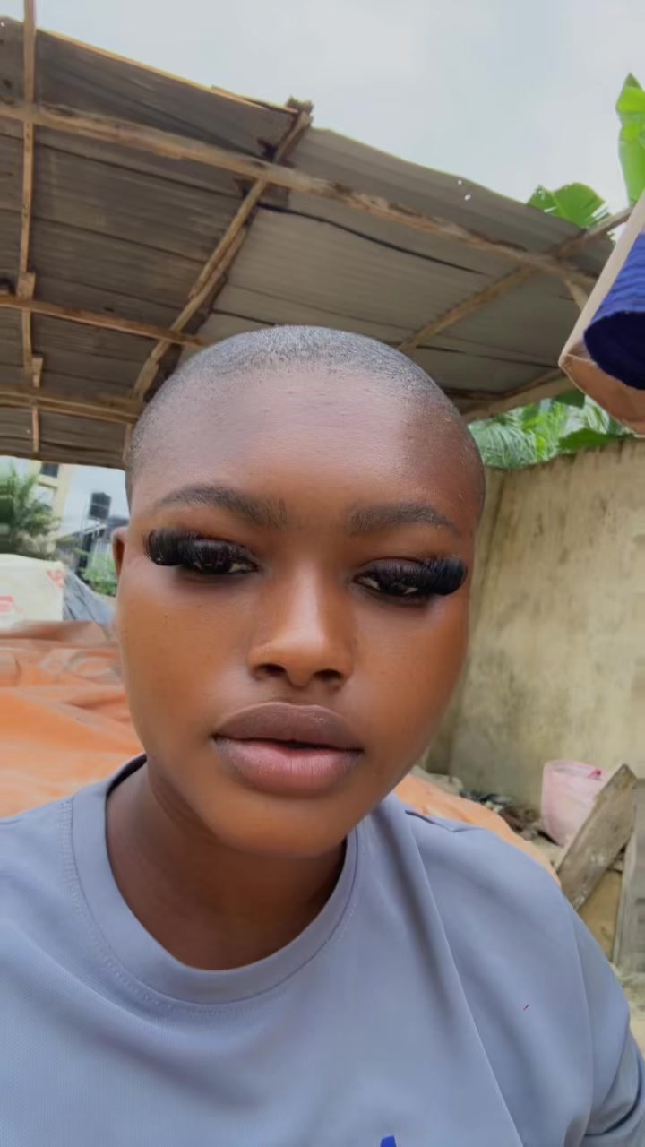 @Baldheadgirl