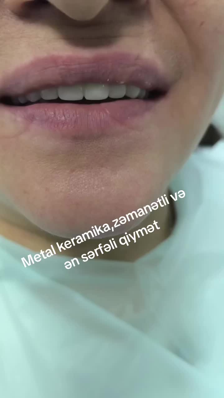 @implant.32
