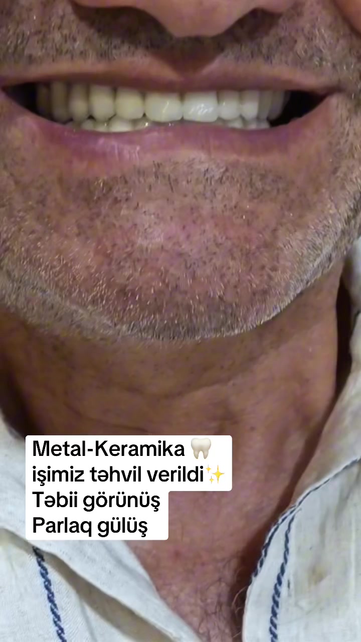 @stomatoloq diş həkimi