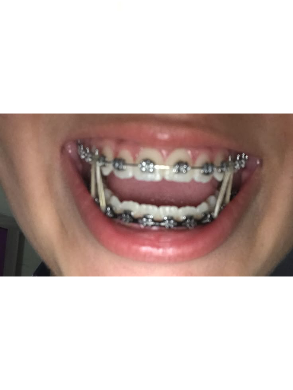 @𝐓𝐆𝐊:𝐍𝐄𝐒𝐊𝐕𝐈𝐊бегает🪽