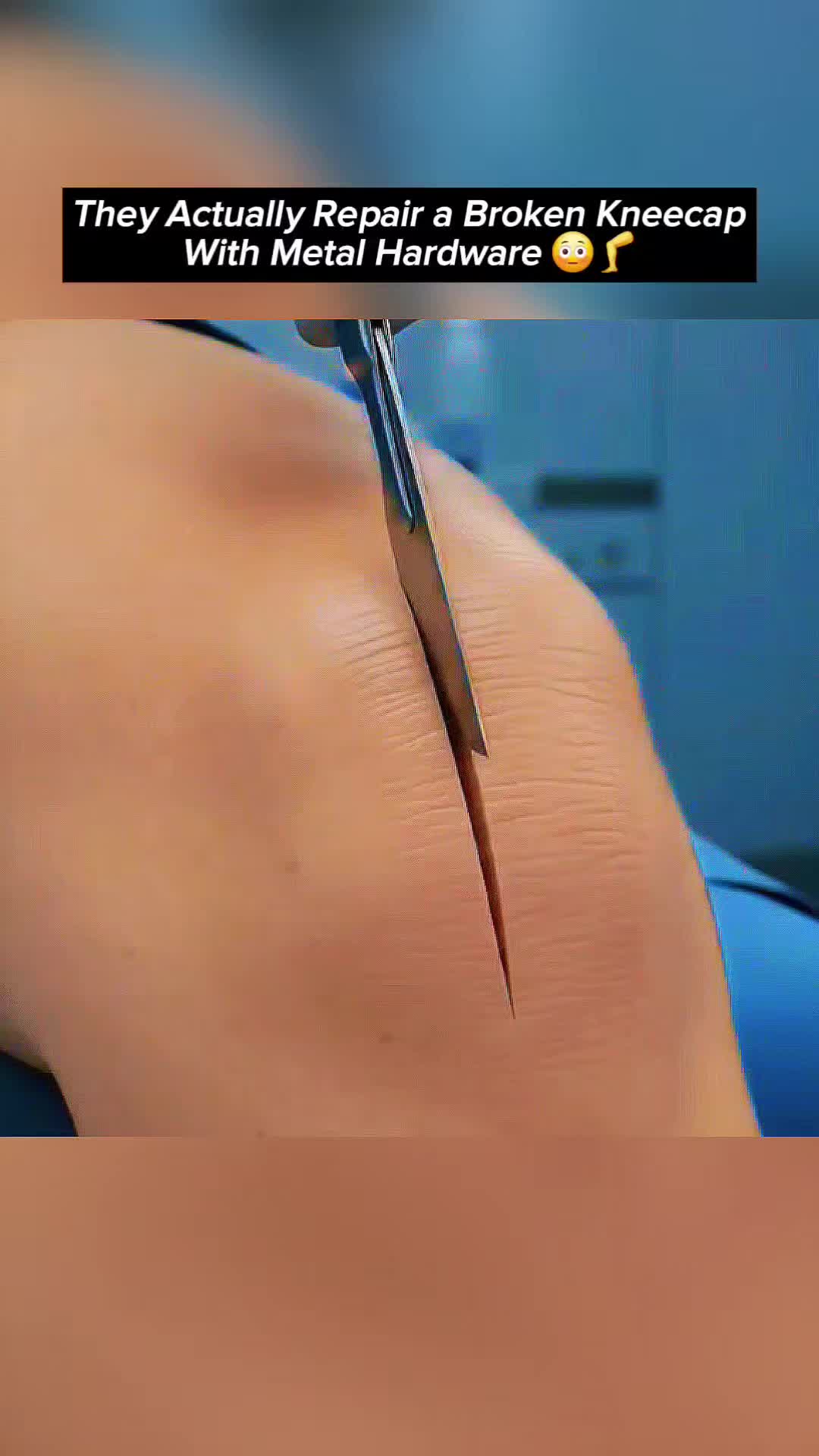 @Femniverse