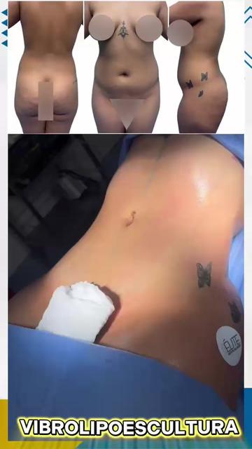 @Élite Estetic Ecuador 🇪🇨