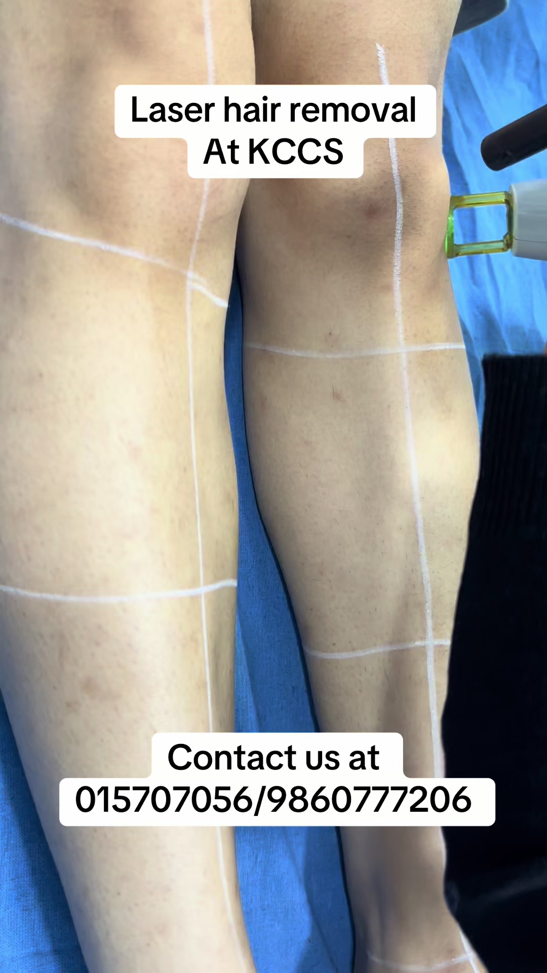 @Dr. Mainali, plastic surgeon