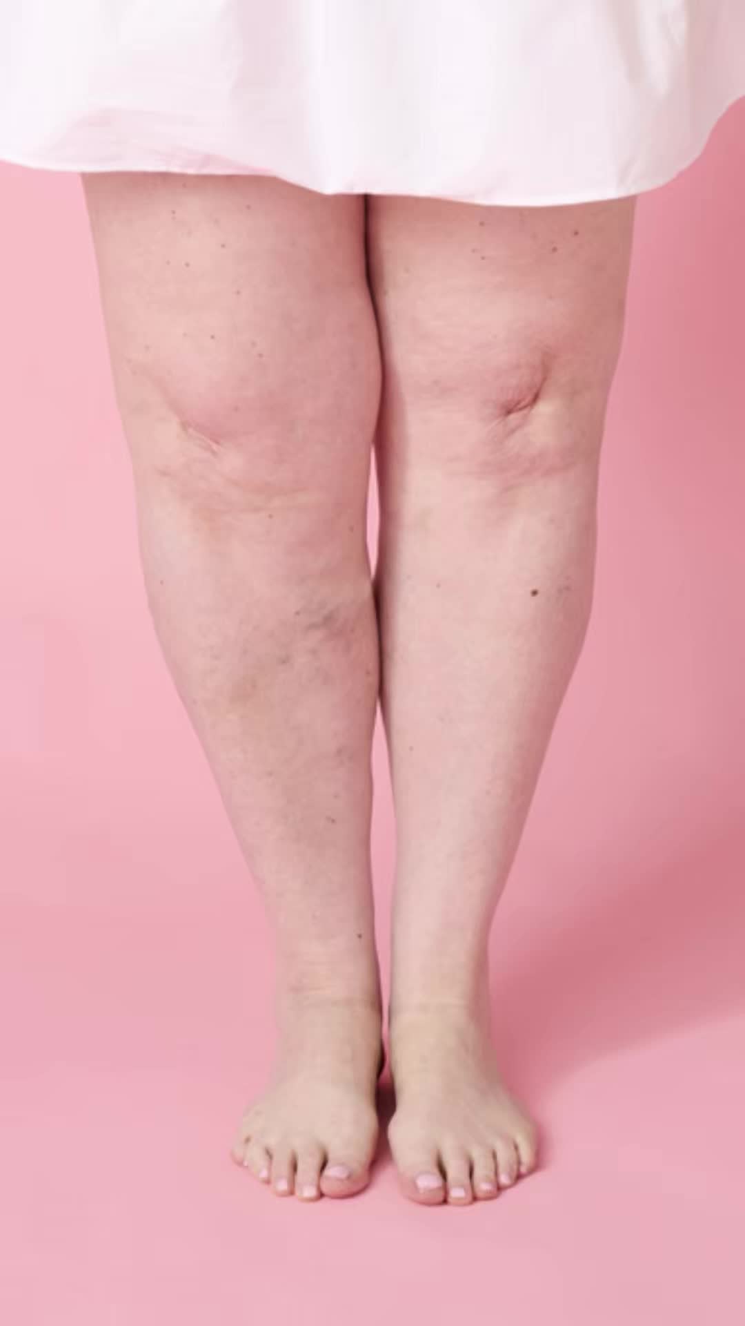 @Skinnies InstantLifts