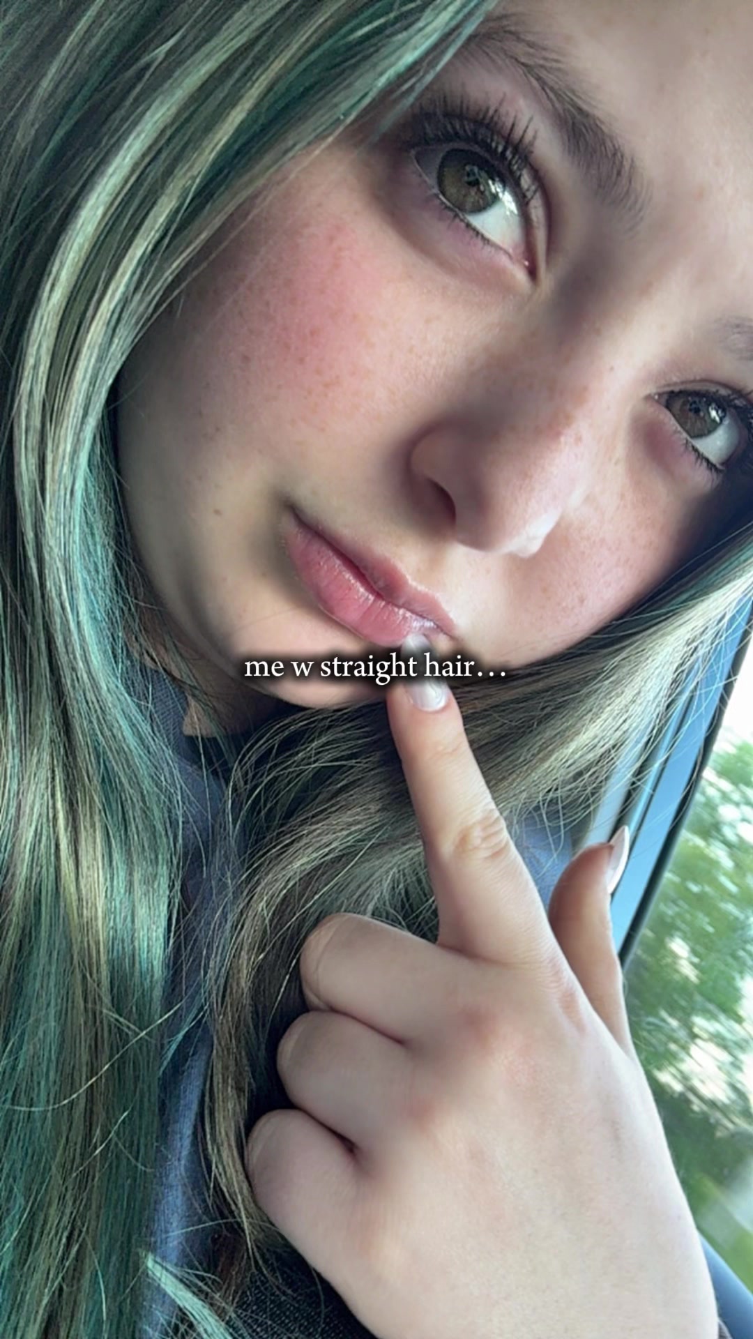 @Ally