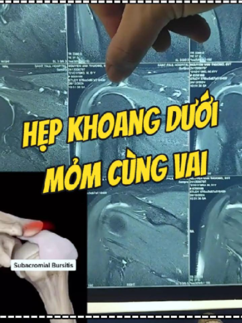 @Chuy&ecirc;n gia xương khớp