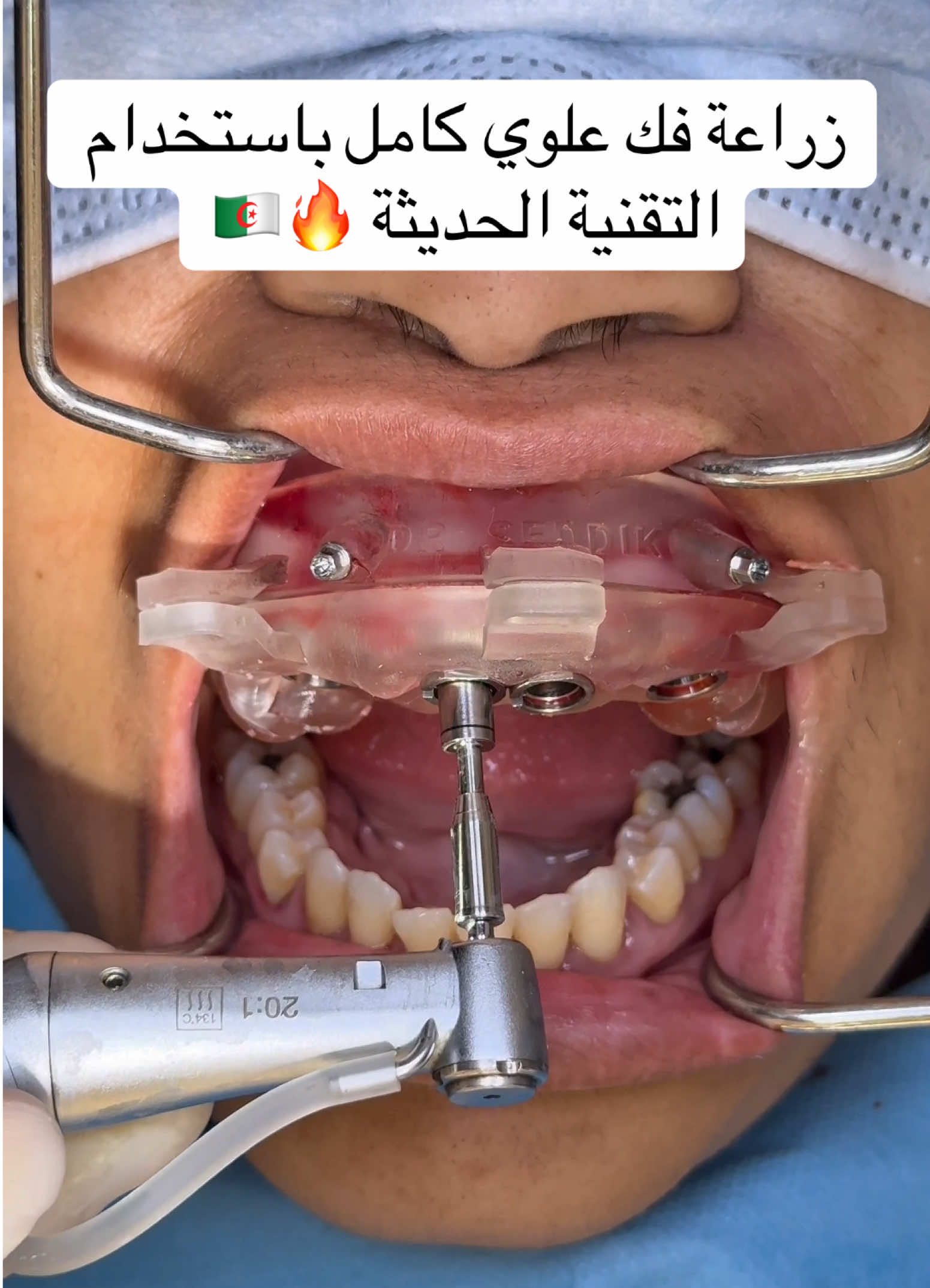 @Dr.ladjali