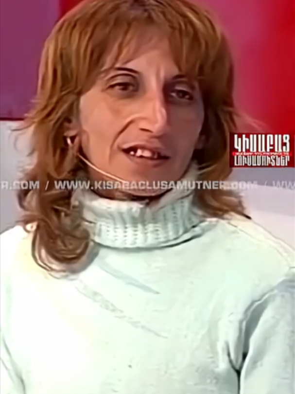 @ԿԻՍԱԲԱՑ ԼՈՒՍԱՄՈՒՏՆԵՐ