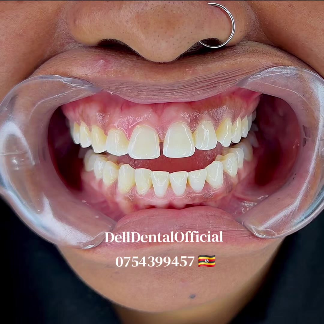 @DellDentalOfficial