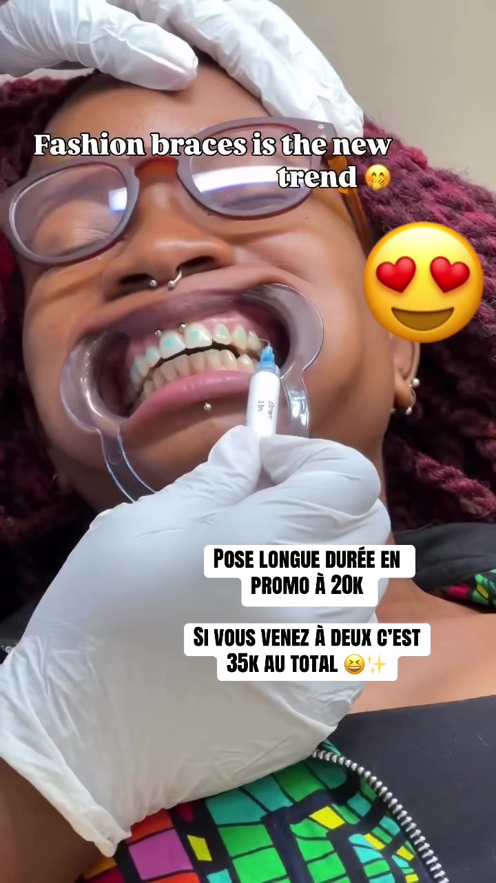 @MG BRACES