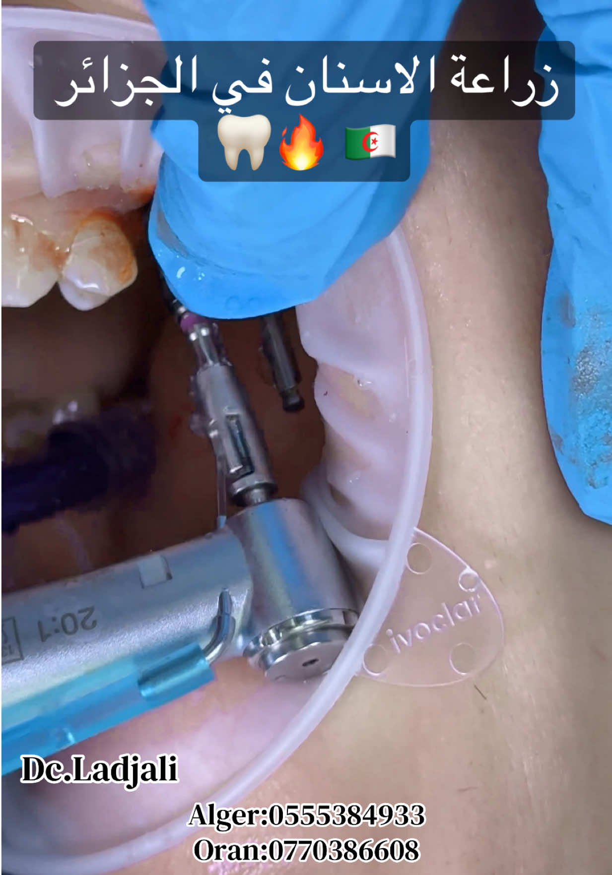 @Dr.ladjali