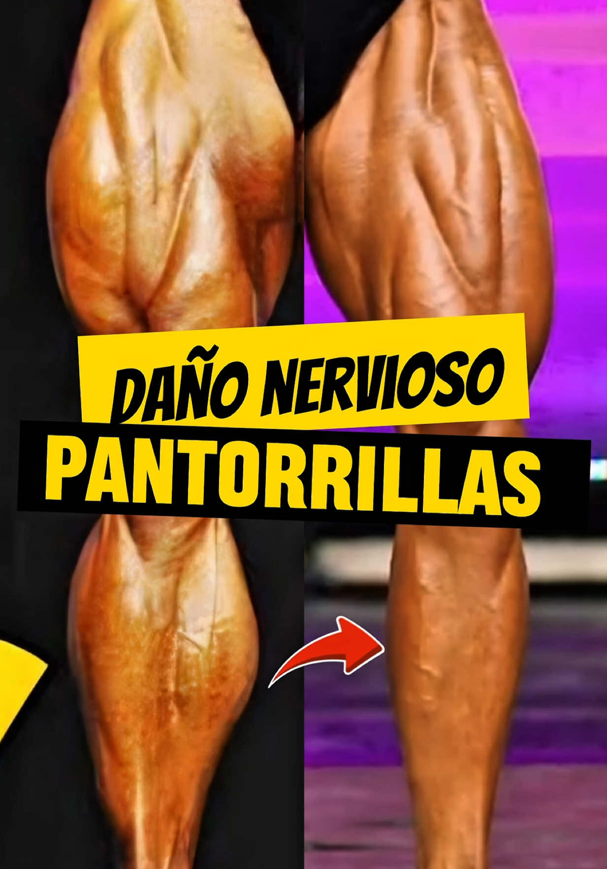 @Fernando Arroyo