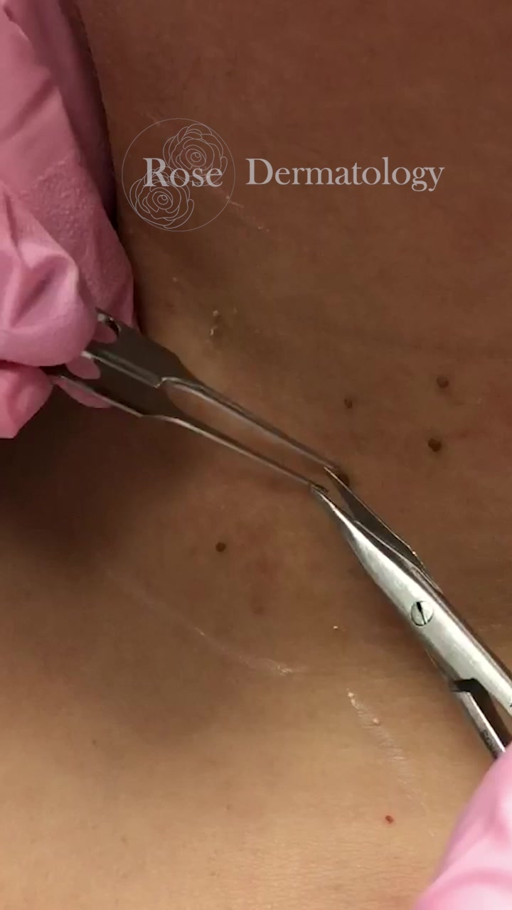@Rosedermnyc