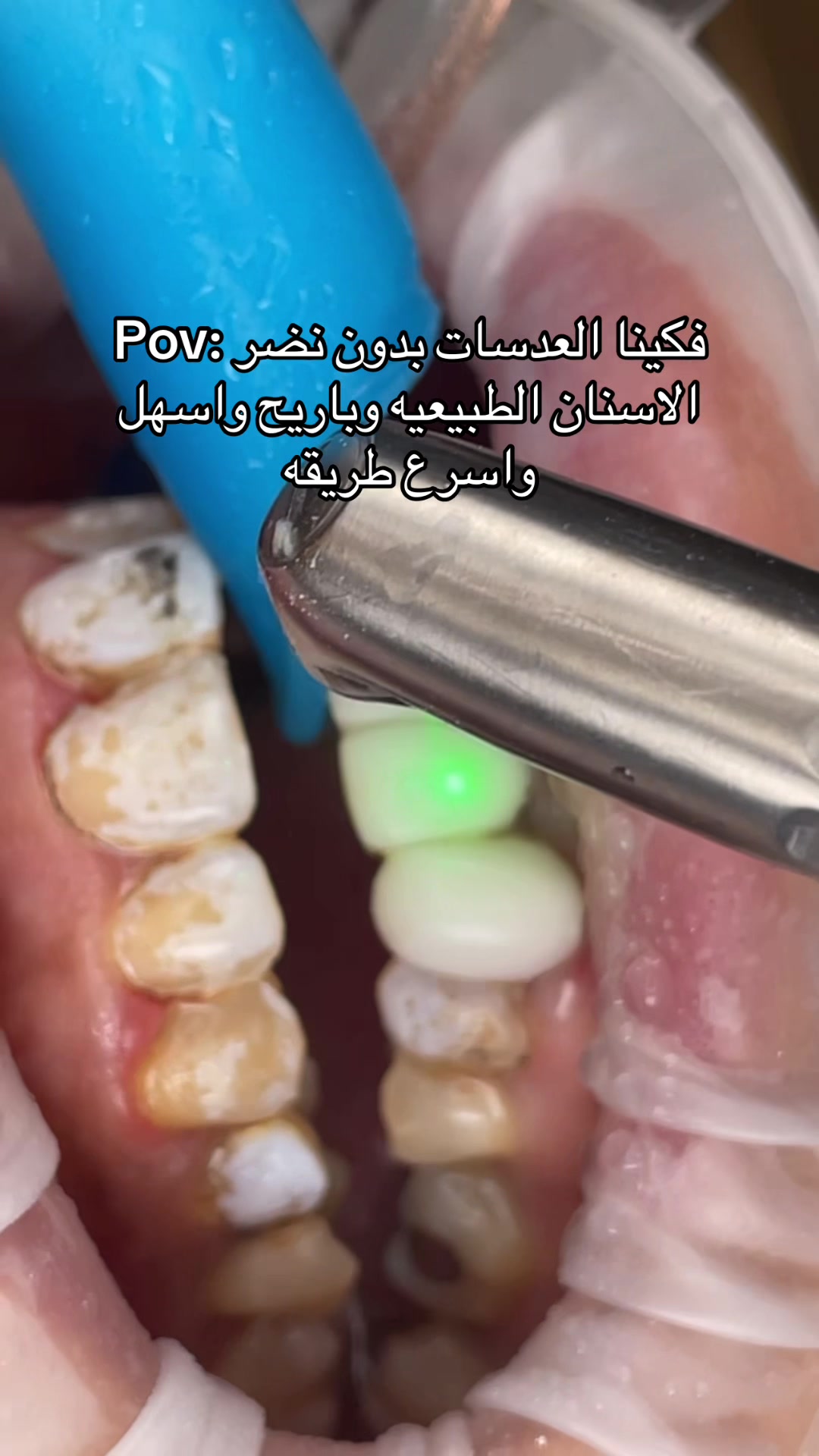@Dr. Abrar Alhababi