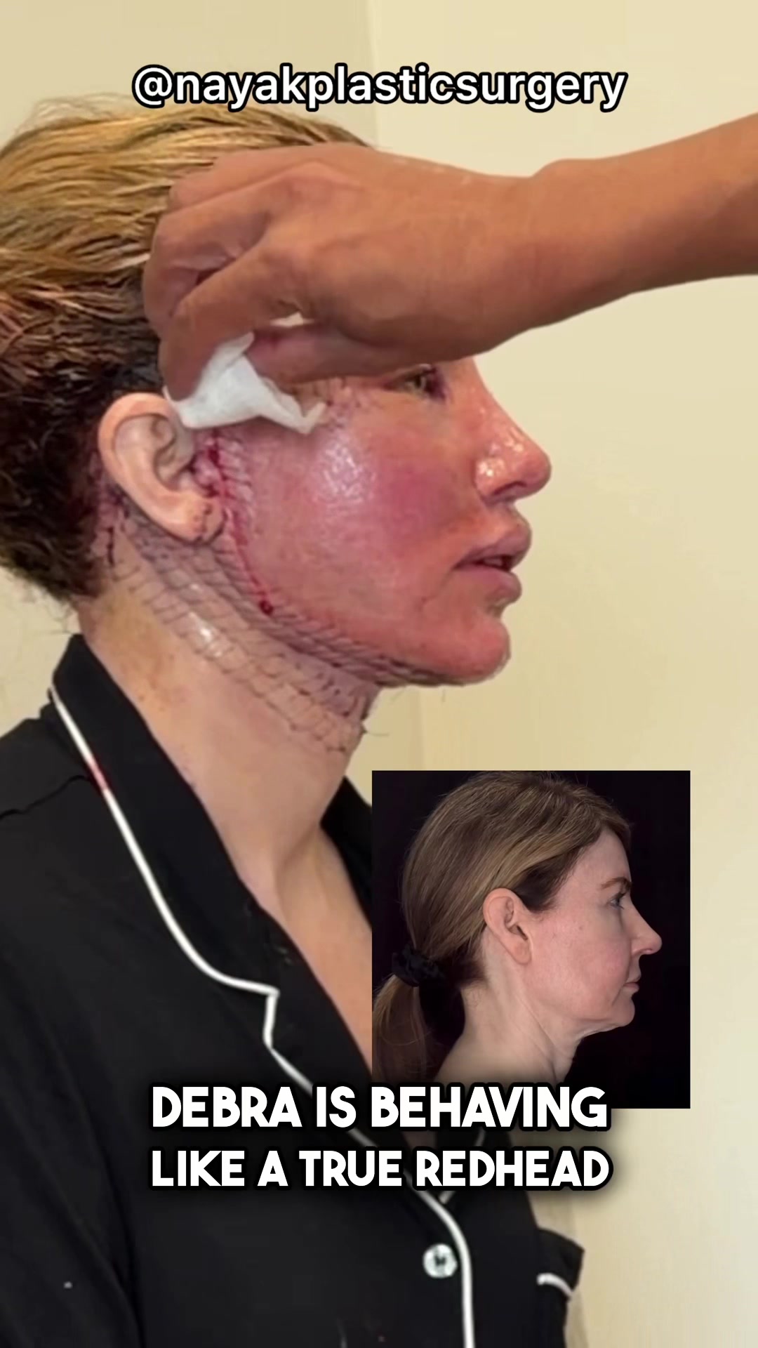 @NayakPlasticSurgery