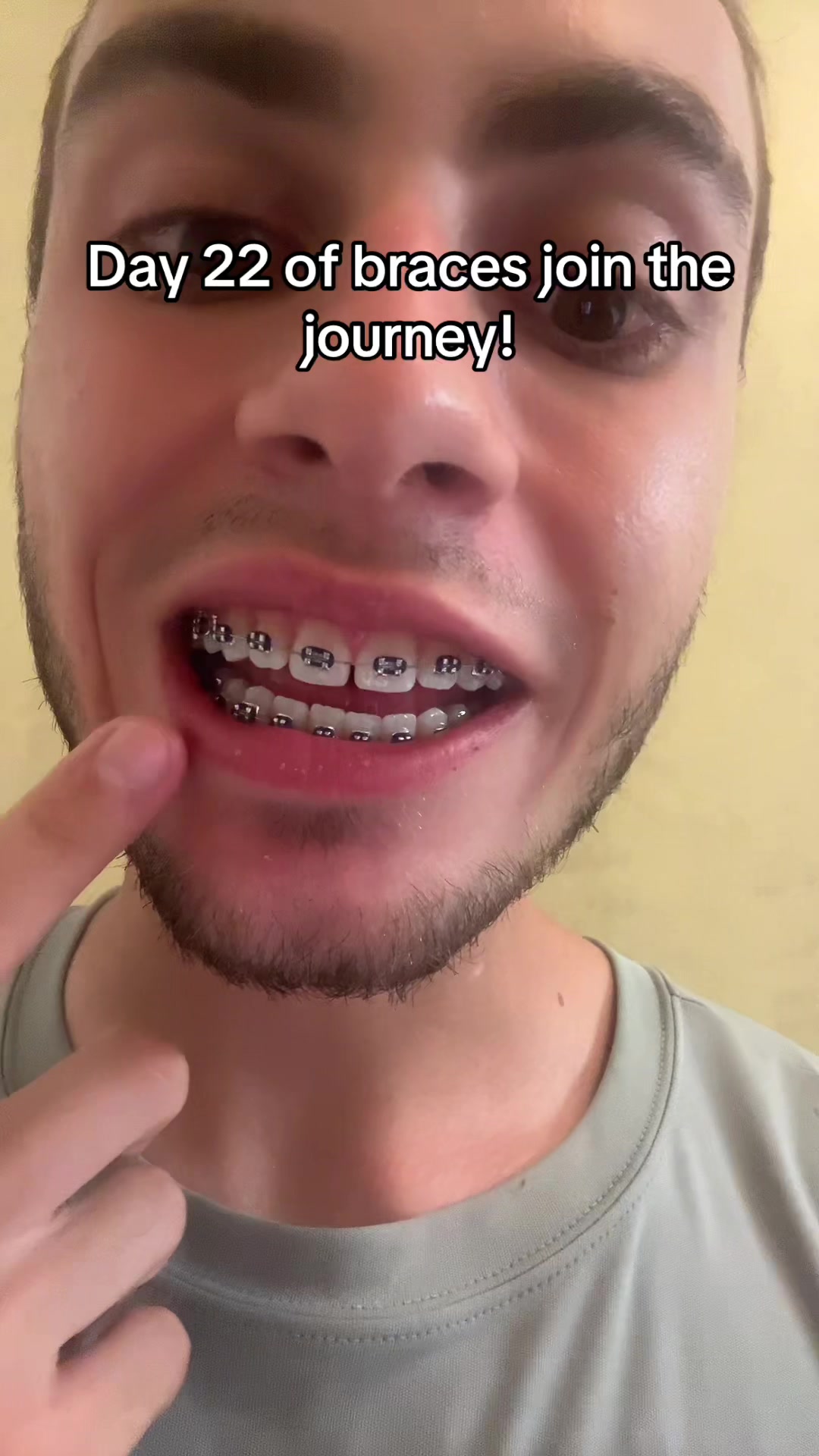 @mysmilejourney