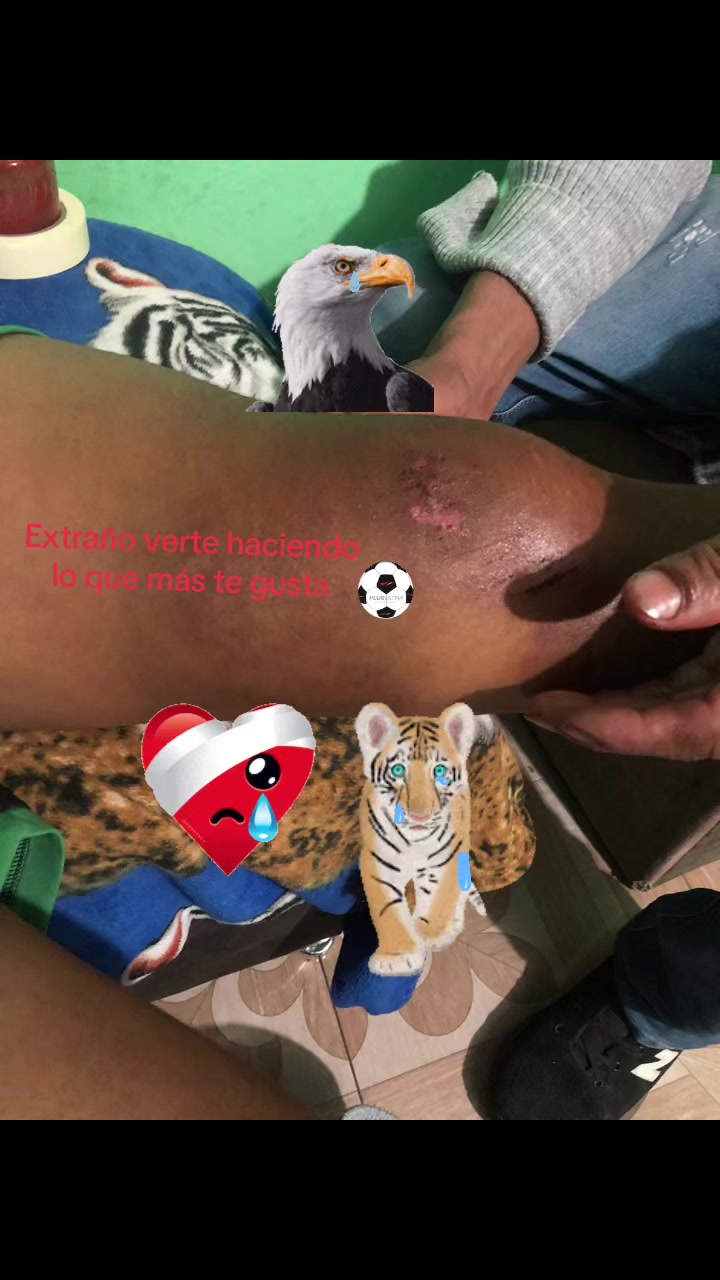 @PEPE THOBÍAS
