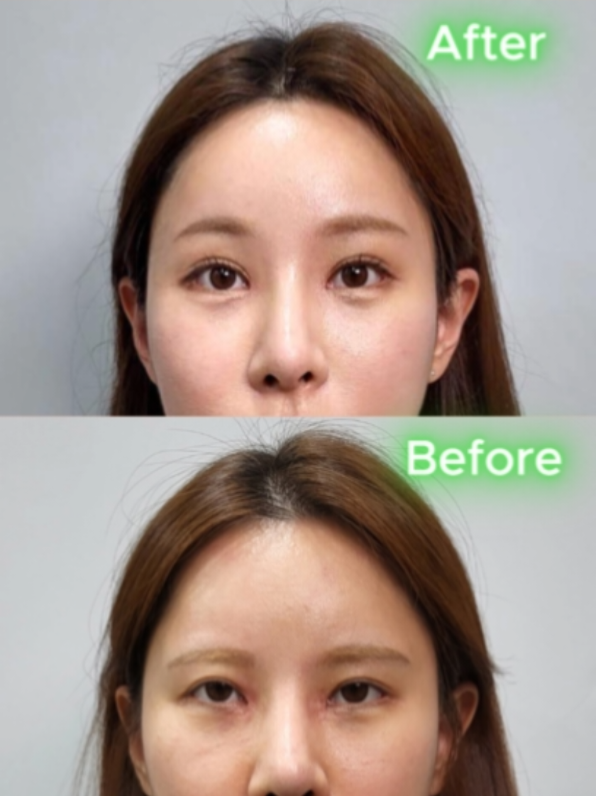 @리프성형외과 김기엽 대표원장
