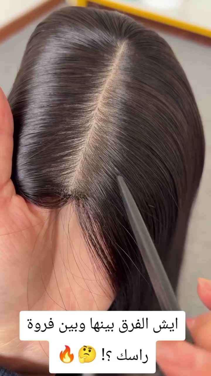 @Flora_Wig