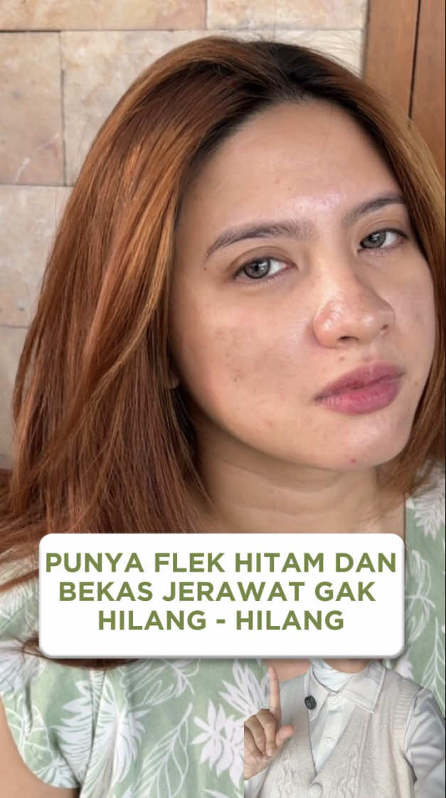 @AmuraOfficial