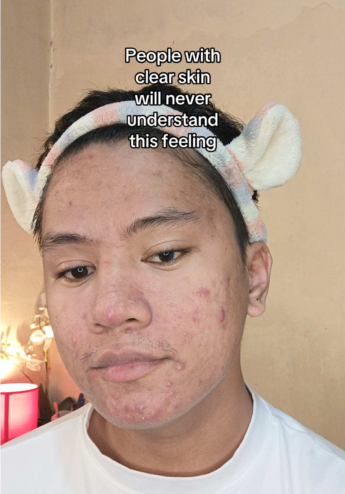 @DYNEL BEO
