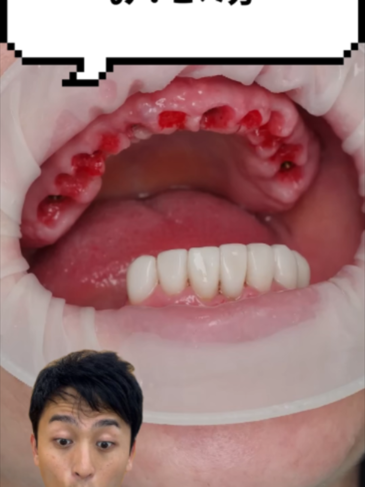 @金歯先生☆歯医者