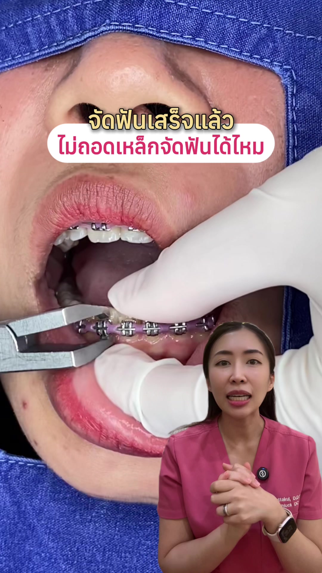 @ณัฐคุณ (Nuttakul Dent) 🦷