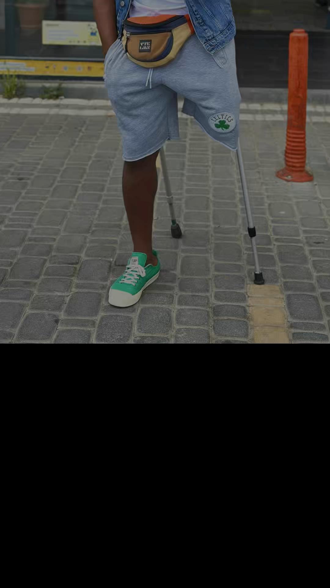 @amputeedinho