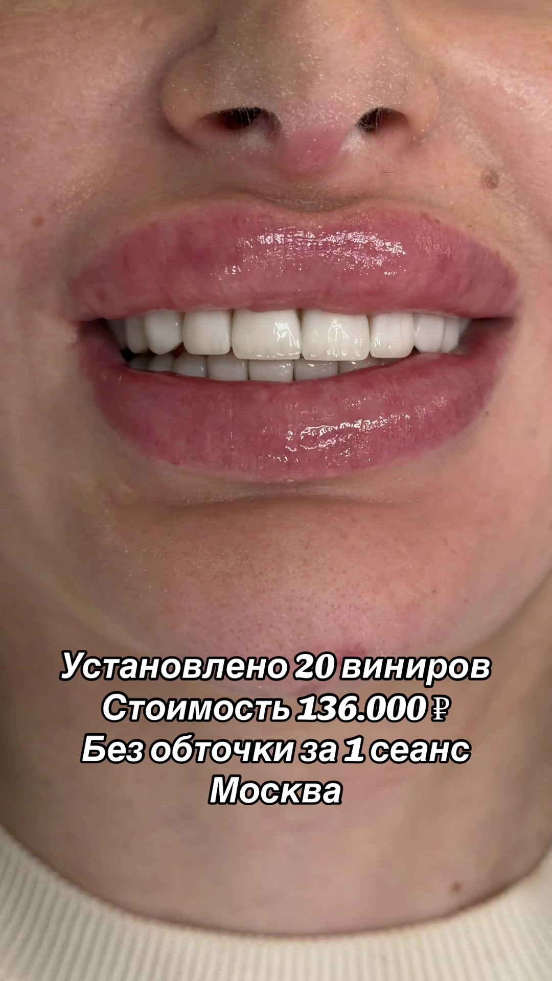 @Royal_smile_moscow