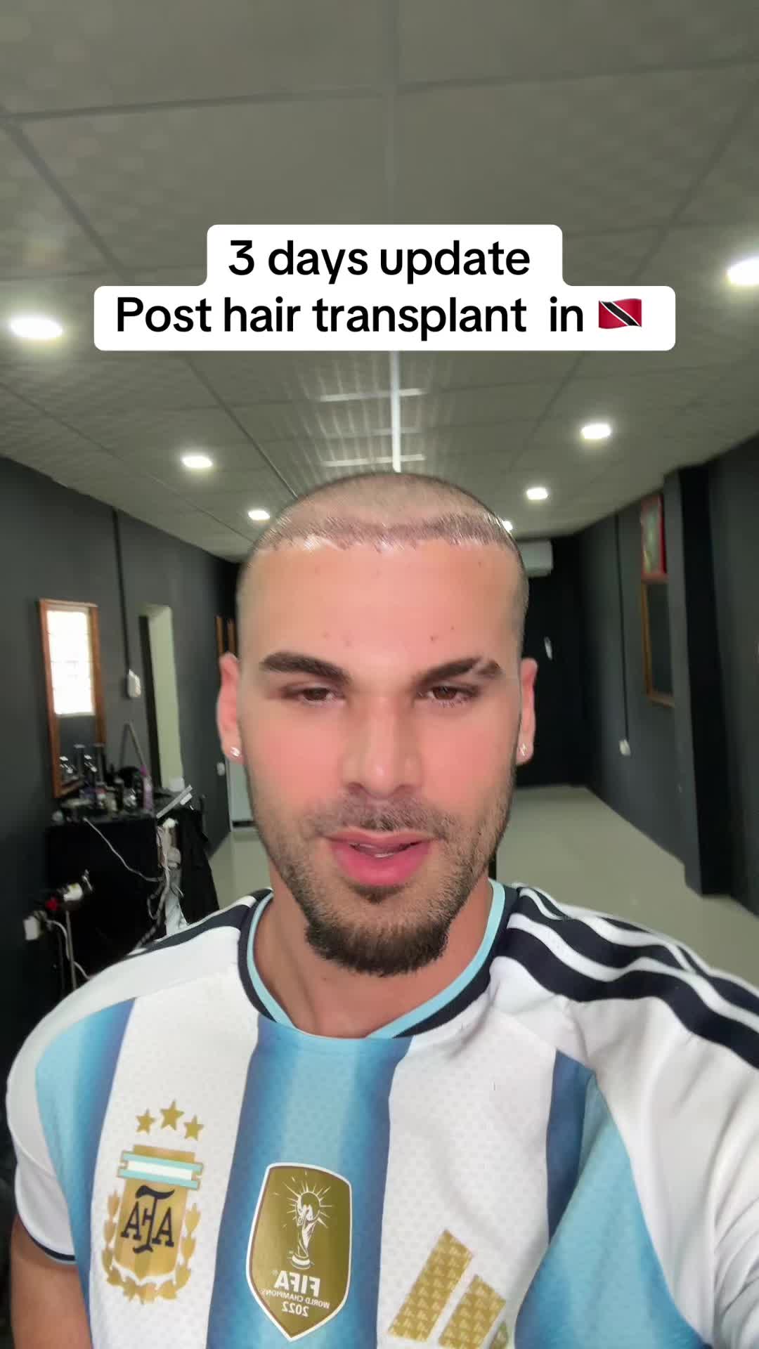 @Alex Bebert🇨🇺🇹🇹