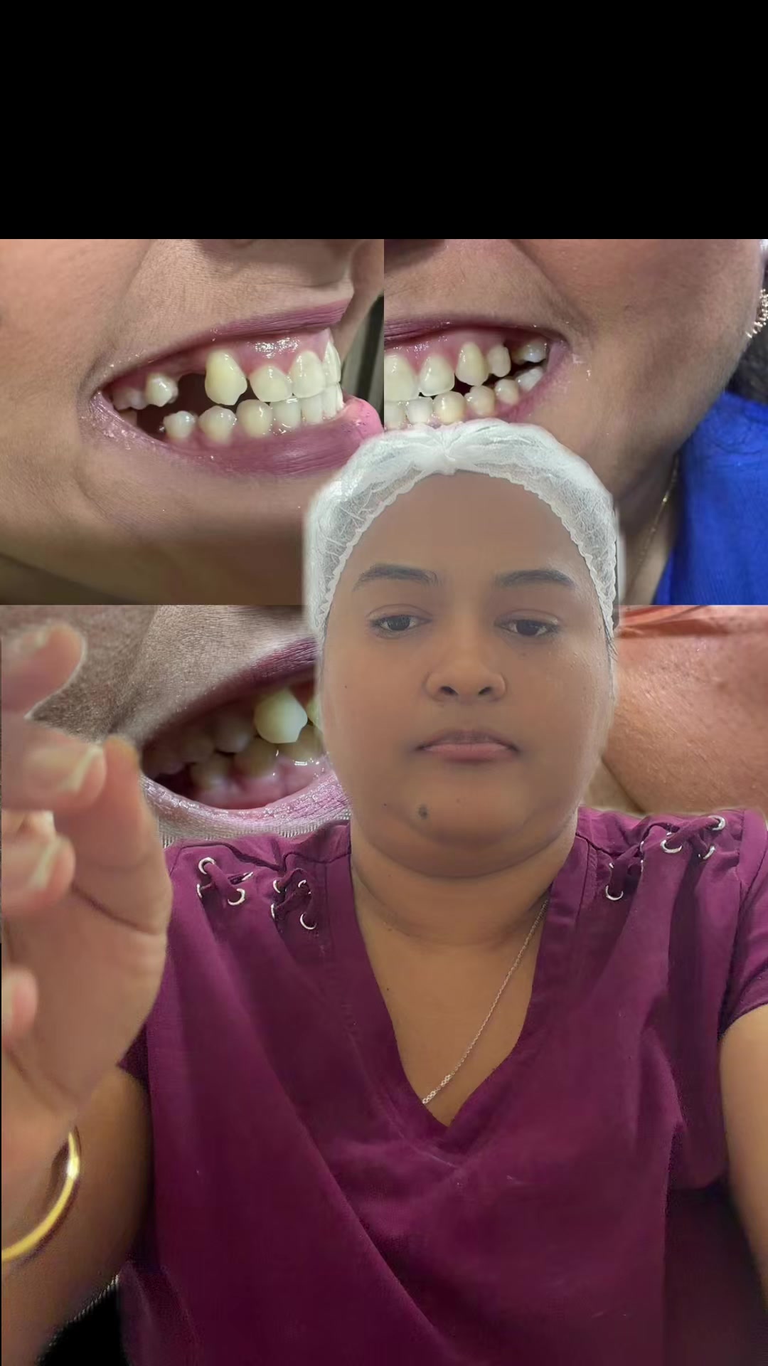 @InesDientes1