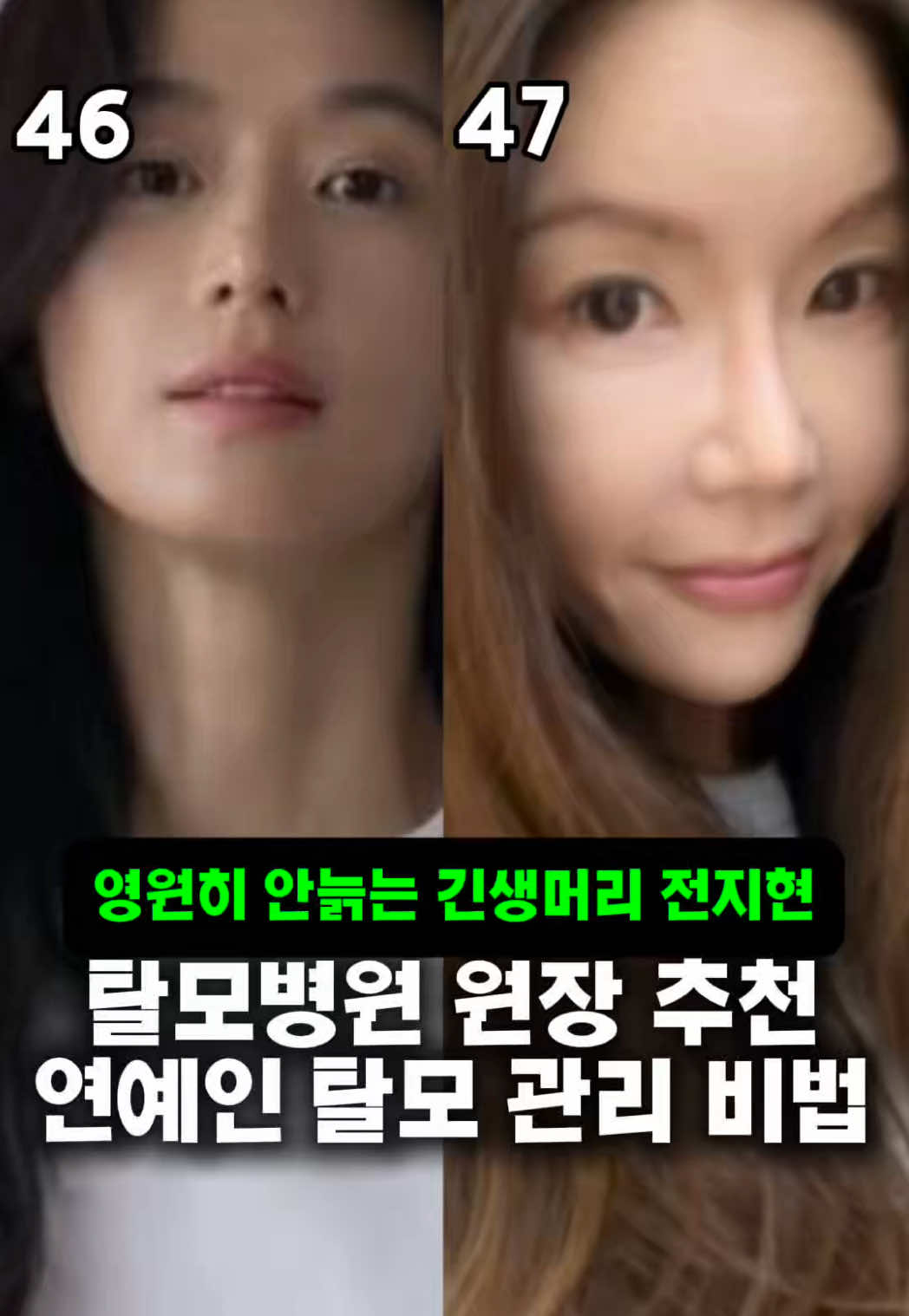 @지나스 GINAS