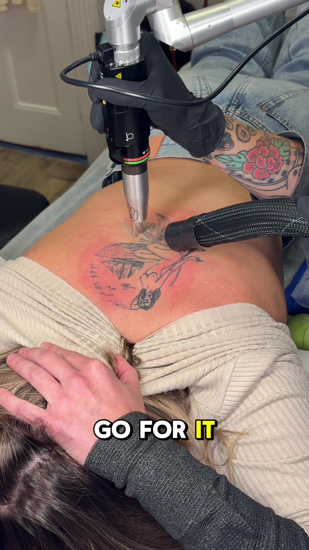 @Swift_tattoo_removal