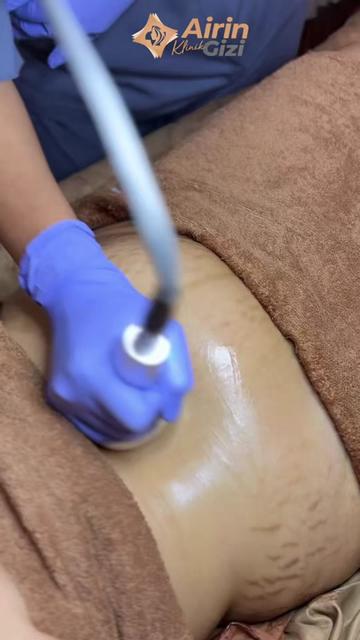 @Airin Klinik Gizi