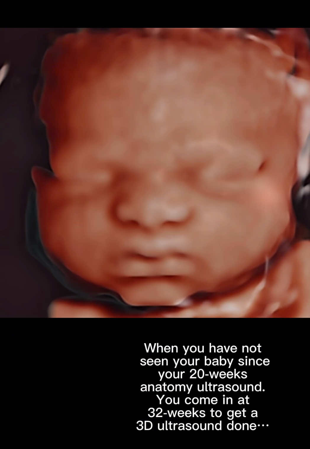 @babyspace3d4d
