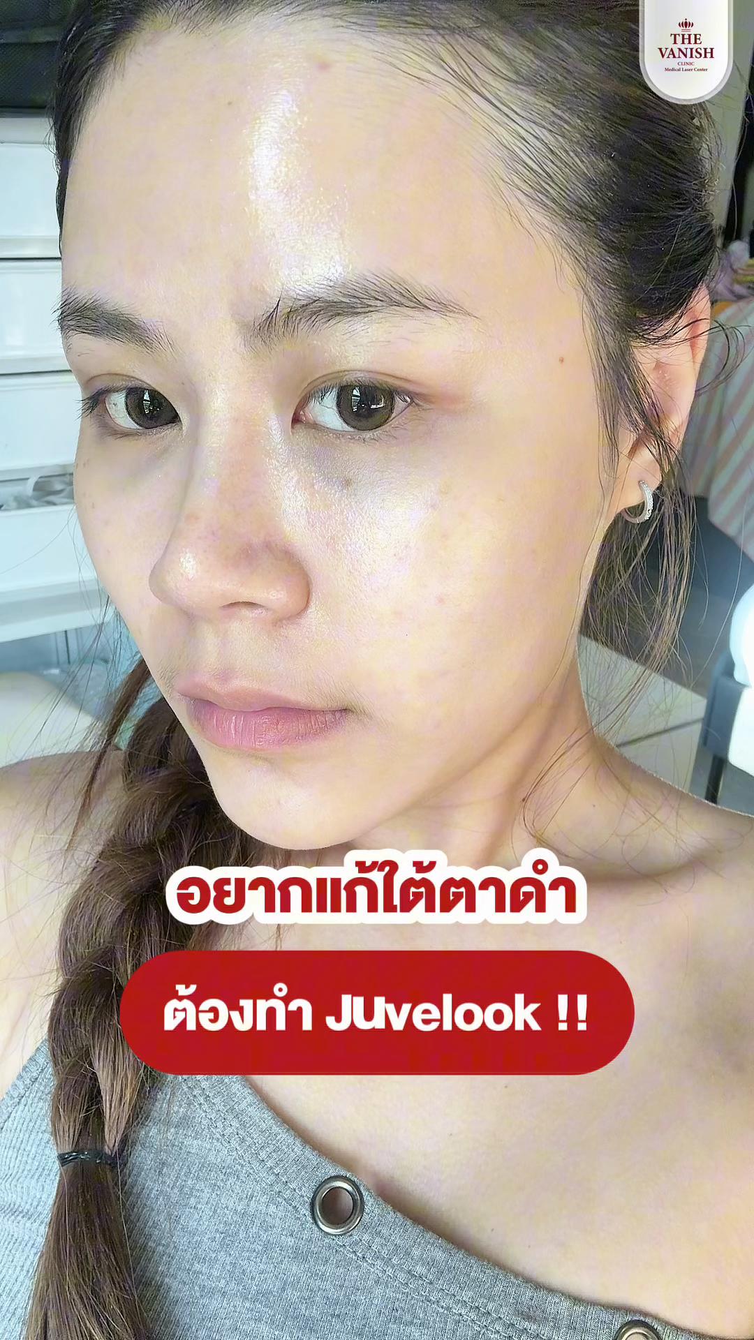 @The vanish clinic