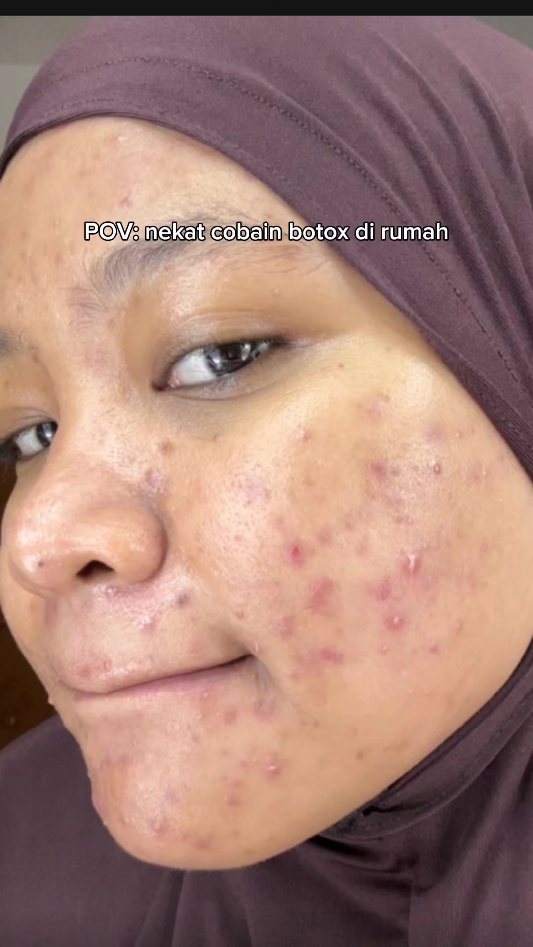 @MBAK CUNGCAT BAYI