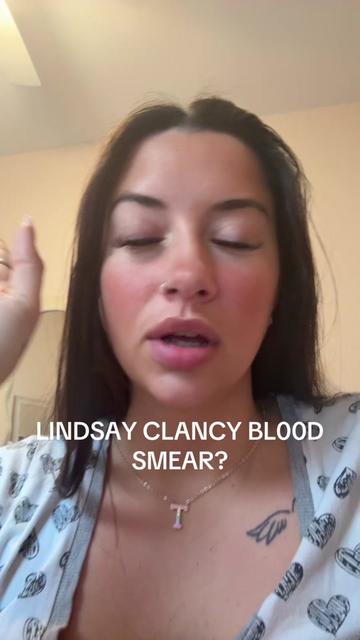 @Lyndz