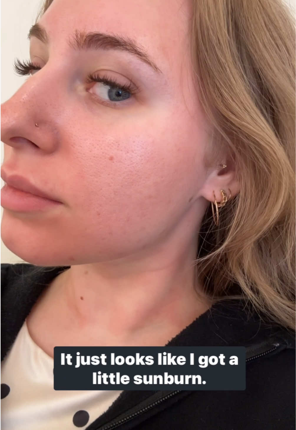 @the_skinbabe