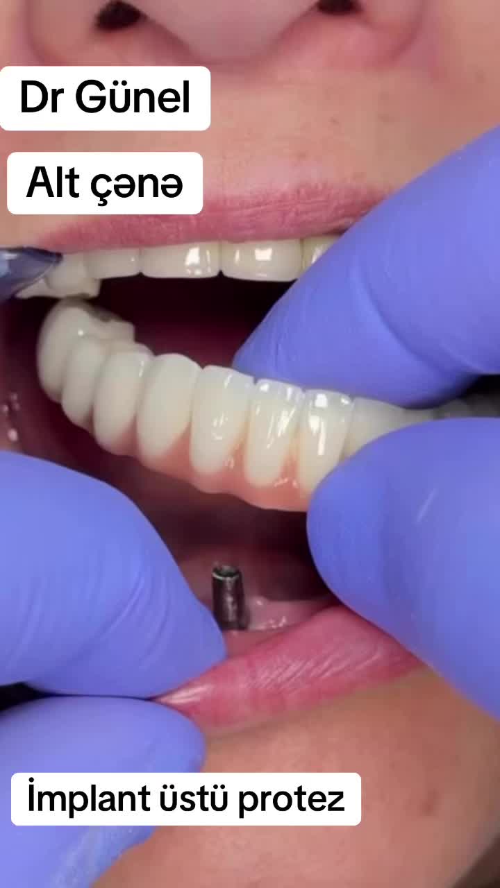 @Dentist_Günel