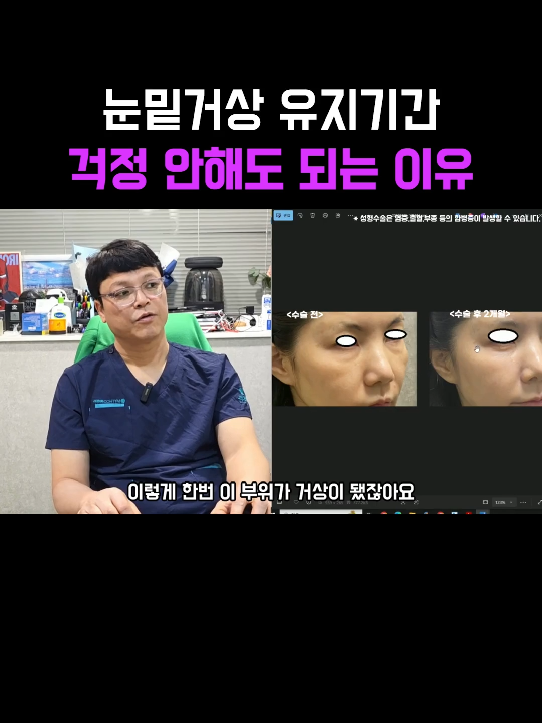 @미오름성형외과