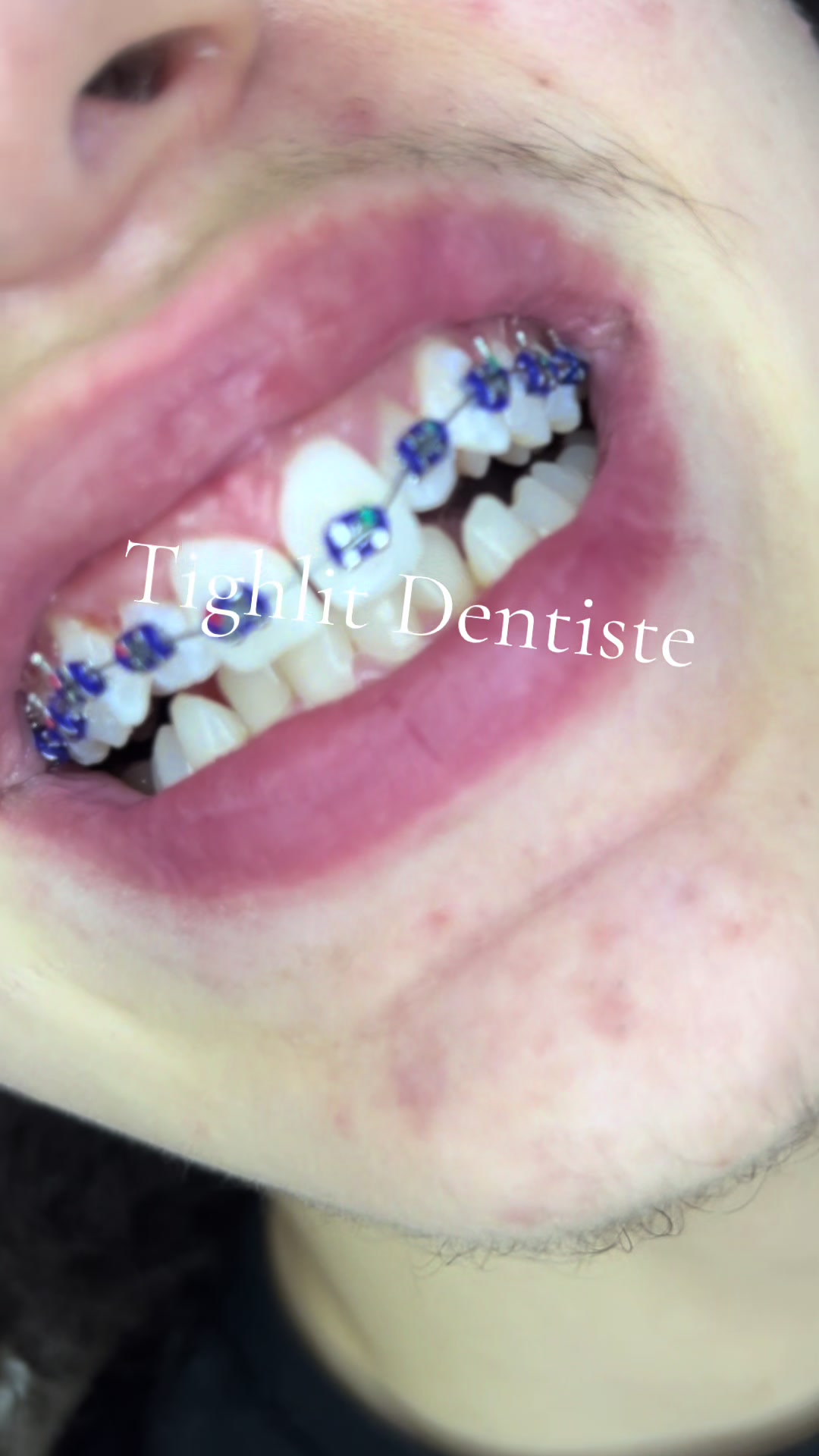 @tighlit_dentiste🦷