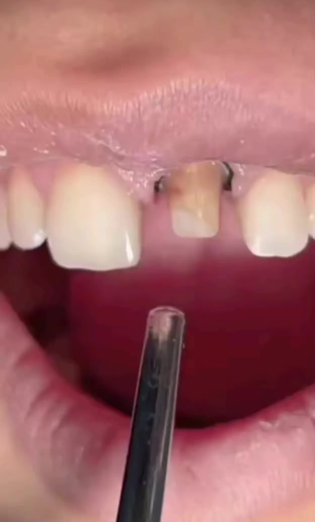 @Dr_sheraz_official 🦷