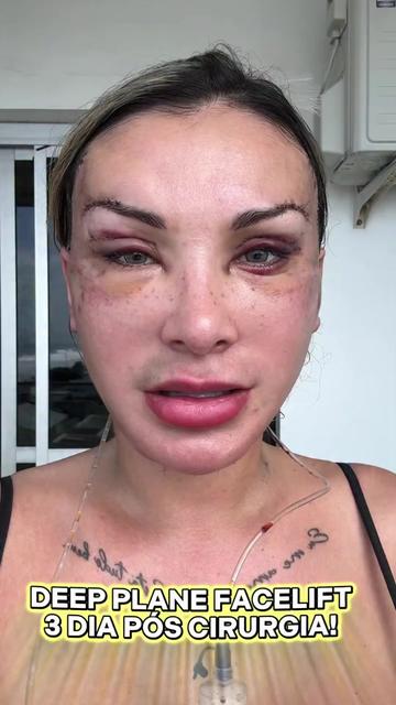 @Andressa Urach