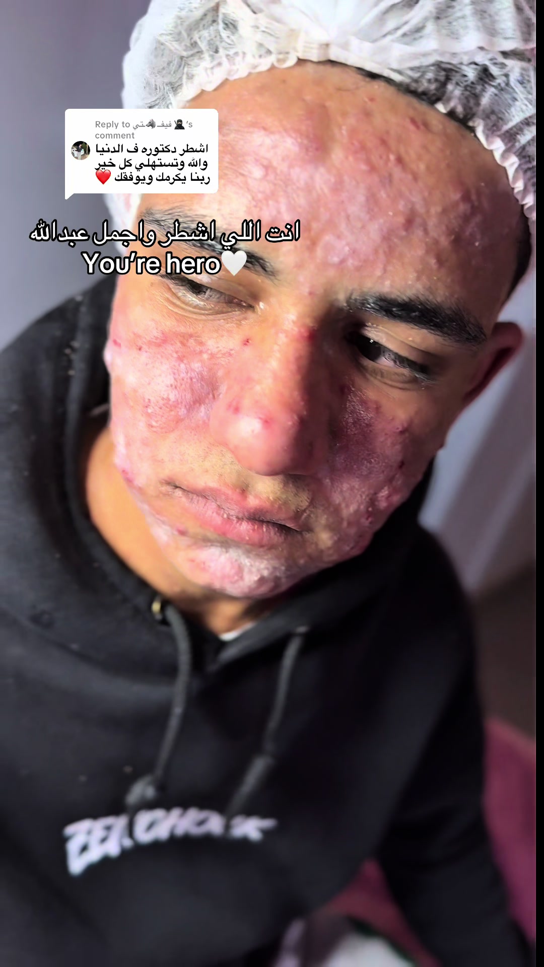@menna_skintherapist