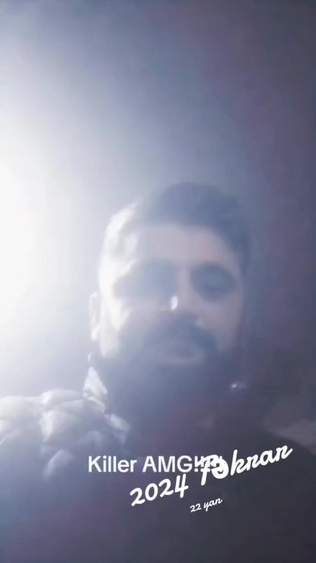 @Anar 313